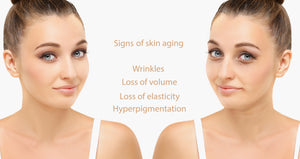 Photoaging is Premature Aging of the Skin Caused by Repeated Exposure to Ultraviolet (UV) Radiation