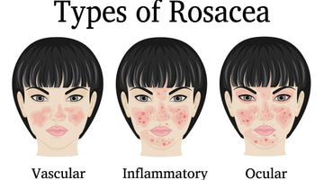 What Kind of Facial Sunscreen Should I use with Rosacea?